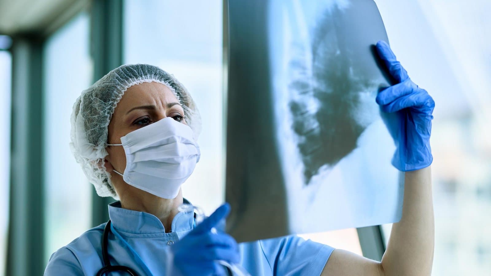 Médica de touca e máscara analisa uma tomografia de tórax contra a luz
